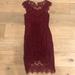 Free People Dresses | Free People Fitted Lace Dress | Color: Red | Size: Xs