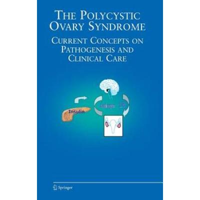 The Polycystic Ovary Syndrome: Current Concepts On Pathogenesis And Clinical Care