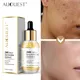 AUCalls EST-Sérum blanchissant pour le visage acide hyaluronique anti-âge déformable essence de