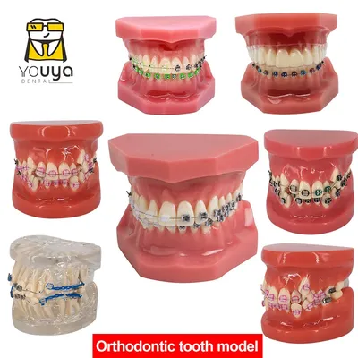 Modèle dentaire avec bretelles matériel de dentisterie modèles orthodontiques modèle de dents en