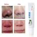 Tebru Skin Care Products Nose Cleaning Cream Rosacea Treatment Cream Nose Redness Removal Cleaning Gel Skin Care Product