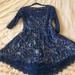 Free People Dresses | Free People Lace Dress | Color: Blue | Size: M