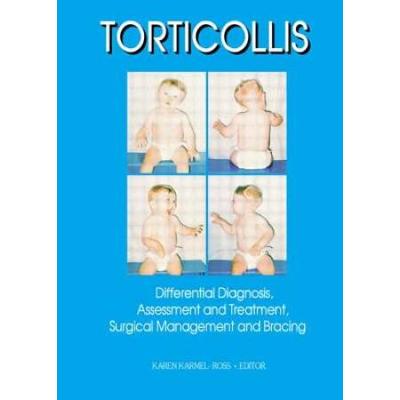 Torticollis: Differential Diagnosis, Assessment And Treatment, Surgical Management And Bracing