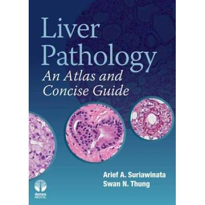 Liver Pathology: An Atlas And Concise Guide