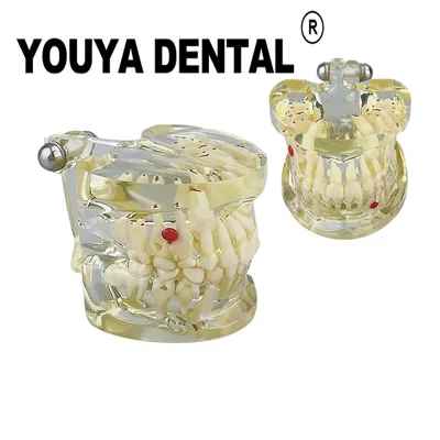 Modèle de dentition pour les dentistes pour la formation à la pratique de la médecine orale outils