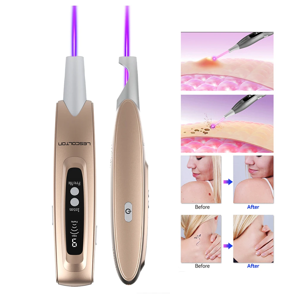 Lescolton – stylo Laser picoseconde, dispositif de thérapie à la lumière bleue amélioré, Machine de détatouage Anti-acné Rechargeable, équipement de beauté