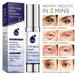 Firming Eye Cream Wrinkles Schminkles Dark Circles Under Eyes Treatment Anti Aging Eye Cream For Wrinkles Dark Circles and Under Eye Bags Temporary Firming Eye Cream Instant Firmx Eye in 2 Mins