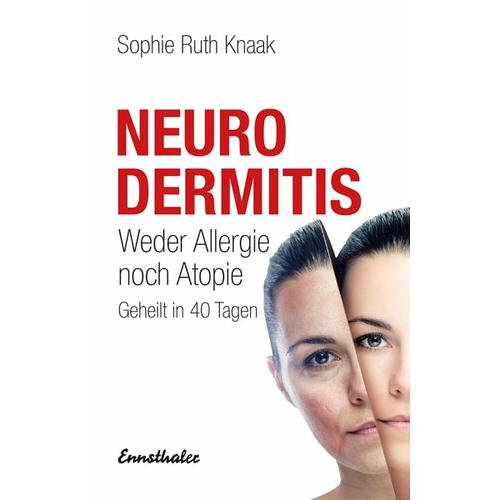 Neurodermitis - Sophie R. Knaak