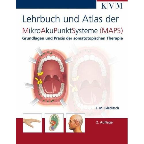 Mikro-Aku-Punkt-Systeme – Jochen M. Gleditsch