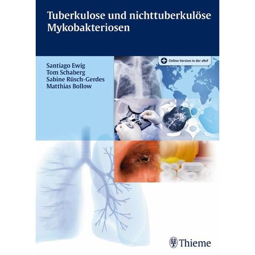 Tuberkulose und nicht tuberkulöse Mykobakteriosen – Santiago Ewig, Tom Schaberg, Sabine Rüsch-Gerdes, Matthias Bollow