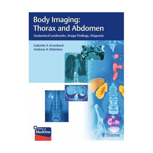 Body Imaging: Thorax and Abdomen – Gabriele A. Herausgegeben:Krombach, Andreas H. Mahnken, Tobias Mitarbeit:Franiel, Andreas Saleh, Lars Grenacher