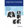 Lung Cancer Screening - Mark Parker, Robert Groves, Joanna Kusmirek