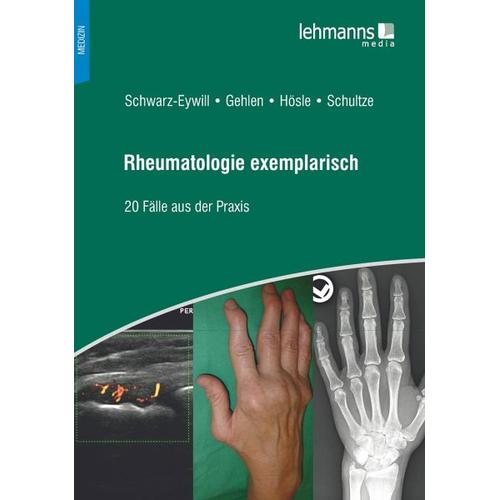 Rheumatologie exemplarisch – Rosmarie Hösle, Michael Schwarz-Eywill, Mareen Schultze