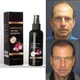 Onion Oil Hair Growth and Anti-hair Loss Treatment Essential Oil Prevents Hair Loss Hair Growth Oil