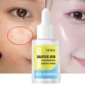 Salicylic Acid Pore Shrink Face Serum Hyaluronic Acid Moisturizing Nourish Smooth Pores Repair