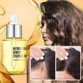 (Buy 3 Get 2 Free)Hair Growth L Oil Fast Hair Growth Essence Hair Growth Essence Anti-frizz Hair Growth Essence Hair Care Oil Reduce Hair Drynessï¼ˆ35mlï¼‰(NEW)