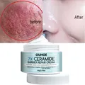 7 Day Face Rosacea Treatment Cream Collagen Intense Repair Redness Dry Sensitive Itching Skin