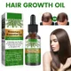 30ml Rosemary Essential Oil For Hair Rosemary Hair Faster Regrowth Oil Anti-frizz Hair Growth Anti