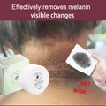 Anti Acanthosis Nigricans Whitening Cream Remove Melanin Armpit Elbow Private Care Products Body