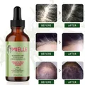Hair Growth Essential Oil Rosemary Mint Hair Strengthening Oil Nourishing Treatment for Split Ends
