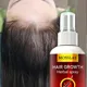 Hair Growth Serum Spray Fast Hair Growth Liquid Treatment Scalp Hair Follicle Anti Hair Loss Natural