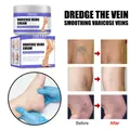 TRSTAY Vein repair cream vein cream leg vein bulge pain Maikang leg care anti aging face cream