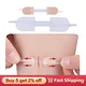 Band-Aid Zipper Tie Wound Closure Patch Hemostatic Patch Wound Fast Suture Zipper Band-Aid Outdoor