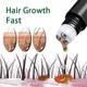 Biotine-Essence à croissance rapide des cheveux huile efficace sérum anti-chute de cheveux