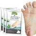 Foot Peel Mask 3 PackÃ¯Â¼Å’ Exfoliator Peel Off Calluses Dead Skin Callus RemoverÃ¯Â¼Å’Baby Soft Smooth Touch Feet-Men Women (Aloe Vera)