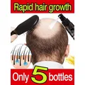 Spray de Croissance des Cheveux au Riz Noir Répare les Dommages Restauration des Cheveux Doux pour