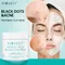 Auquest Salicylsäure Akne Behandlung Gesicht Ton Maske Mitesser schwarzen Punkt Entferner Gesichts maske Hautpflege Schönheit Gesundheit Kosmetik