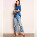 Free People Jeans | Free People 100% Cotton Busted Knee Distressed Ankle Cropped Crop High Rise Jean | Color: Blue | Size: 29