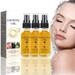 3PCS Natural Skin Care Oil Castor Oil Black Seed Oil Rose Hip Face Essence Rose Hip Oil Black Seed Oil Castor Oil Face Serum Skin Care Moisturizing & Nourishing Face Skin