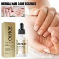 Bwomeauty Herbal Nail Essence Herbal Nail Essence Herbal Nourishing Fingernail Nail Oil For Weak And Damaged Nails 30ml on Clearance