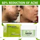 AILKE-Soin naturel anti-acné pour homme et femme traitement réparateur contre les taches d'acné
