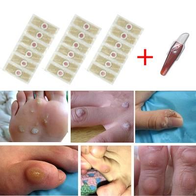 24pcs Medical Foot Care Stickers For Corn Removal, Warts, Thorns, Calluses, Detox Heal Your Feet