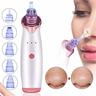 Blackhead Remover Vacuum Electric Pore Vacuum Facial Pore Cleaner Acne Comedone Extractor kit 5 Removable Probes 5 Adjustable Suction Force for All Skin Treatment USB Rechargeable