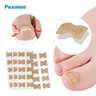 Pexmen 10/20/50/100Pcs adesivo per la correzione dell'unghia incarnita Kit per la cura del piede