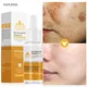 Vitamin C Whitening Face Serum For Dark Spots Freckles Remover Essence Fade Melasma Melanin Brighten