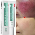 Fast Repair Facial Redness Cream Sooth Itching Sensitive Skin Improve Rosacea Remove Acne Nourish