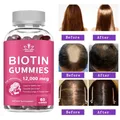 Collagen Gummies Biotin Gummies for Skin Care Health Nails Hair Growth Vitamins Collagen Protein