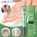 Cuticle Remover Oil Nail Oil Cuticle Nail Strengthener Nail Growth Care For Peeling Breaking Thin