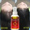 Hair Growth Serum Spray Fast Hair Growth Liquid Treatment Scalp Hair Follicle Anti Hair Loss Natural