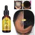 Fast Hair Growth Men Women Ginger Growth Hair Oil Treatment Anti Hair Loss Scalp Treatment Serum