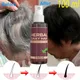 Gray White Hair Treatment Spray Serum Liquid Repair Fast Regrowth Nourish Damaged ScalpBlack Hair