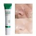 ELES 1/2/3PCS Acid Pore Refining Cream Salicylic Face Cream Professional Pore Minimizer Refine Pores And Improve Blackheads Moisturizing Repairing 20g best service