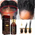 Trattamento per capelli Alopecia per le donne perdita di capelli strumento per la crescita dell'olio