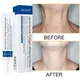 Neck Anti-Wrinkle Cream Collagen Wrinkle Removal Anti-aging Firm Whitening Brighten Moisturizingn