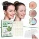 144Pcs Acne Pimple Patch Stickers Waterproof Acne Treatment Pimple Remover Tool Blemish Spot Facial