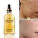 SUMDUINO The Gold Nicotinamide Liquid 24K Gold Essence Muscle Bottom Liquid Rehydration Moisturizes 30ML Gentle Formula